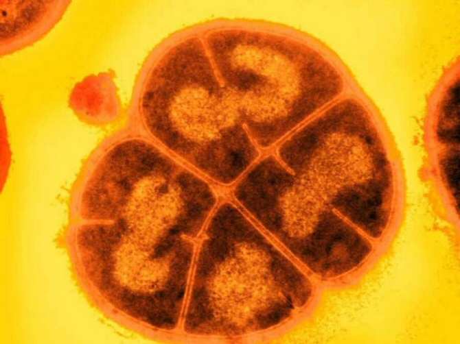 El secreto de la bacteria que soporta una radiactividad miles de veces mayor que la mortal para el ser humano
