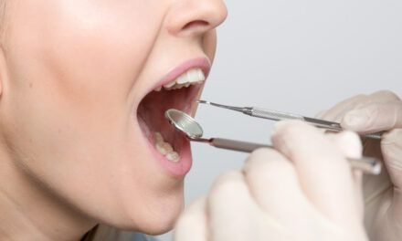 Adiós a las fiestas: ¡A saludar la salud bucal luego de los excesos cometidos!