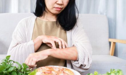 Alergia alimentaria, ¡Cuidado con lo que comes!