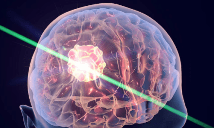 Desarrollan una linterna molecular para detectar metástasis en el cerebro