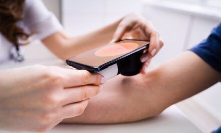 Una prueba de sangre basada en genes detecta signos tempranos de recaída en melanoma