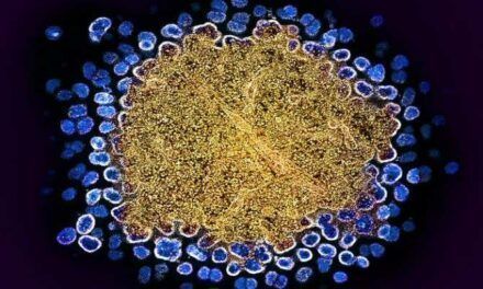 Una inyección cada 6 meses para prevenir la infección por el virus del SIDA