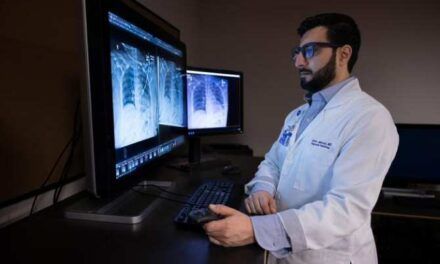 Inteligencia artificial para examinar radiografías