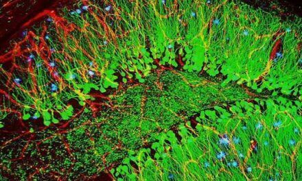 Terapia génica que podría detener la enfermedad de Alzheimer