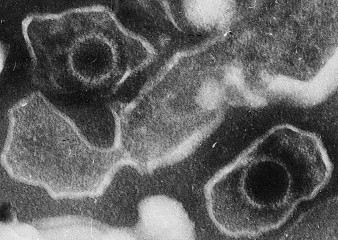 Virus indetectados: los huéspedes invisibles que habitan en nuestro cuerpo durante toda la vida