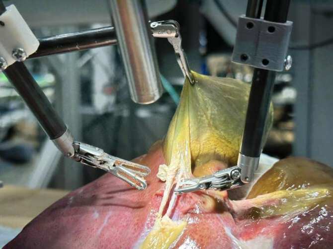Cirugía hecha sin ayuda humana por un robot con inteligencia artificial