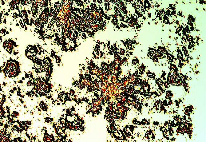 Diseñan con inteligencia artificial una molécula con potencial para tratar la enfermedad de Alzheimer