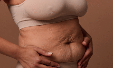 Madres renovadas: cirugía plástica después del embarazo