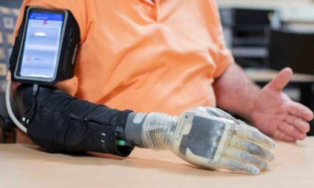 Prueban una mano protésica robótica con sentido del tacto