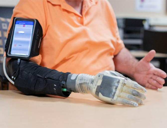 Prueban una mano protésica robótica con sentido del tacto