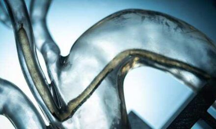 Robot lombriz capaz de circular por el interior del cuerpo humano