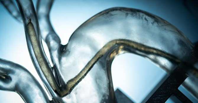 Robot lombriz capaz de circular por el interior del cuerpo humano