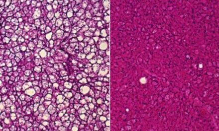 Nueva vía potencial para adelgazar haciendo que el metabolismo genere más calor corporal