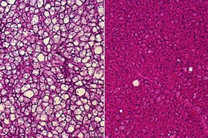 Nueva vía potencial para adelgazar haciendo que el metabolismo genere más calor corporal