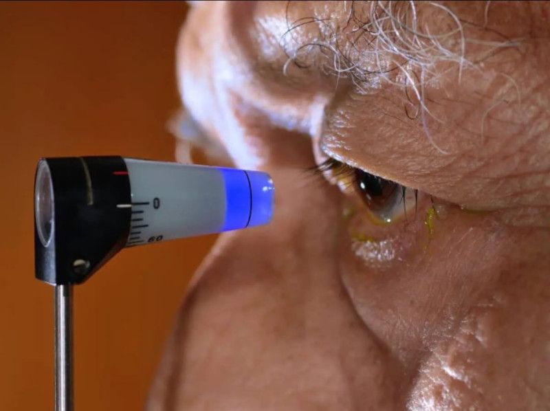 Oftalmología oncológica: La especialidad poco conocida que detecta un tumor en el ojo