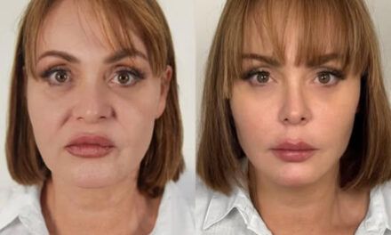 Gaby Spanic muestra su rostro tras someterse a un rejuvenecimiento facial y se vuelve viral en redes