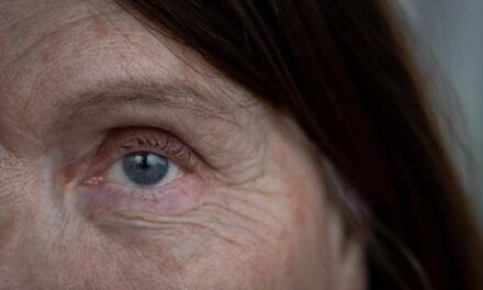 Nuevo tratamiento láser para frenar la degeneración macular asociada a la vejez