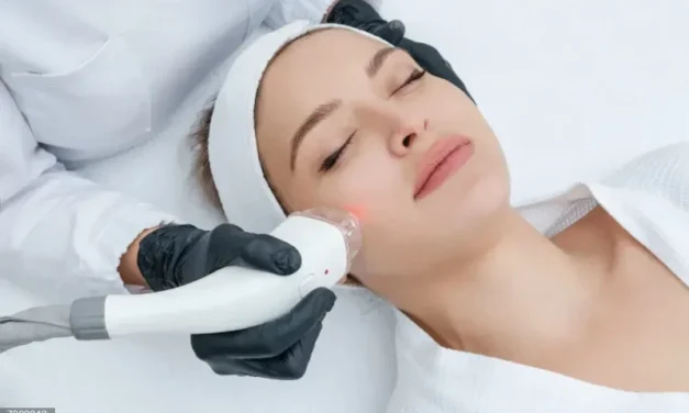 Experta destaca que láser dermatológico permite tratar cicatrices y manchas de forma más precisa