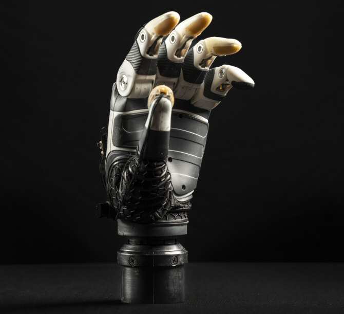 Mano biónica provista de inteligencia artificial