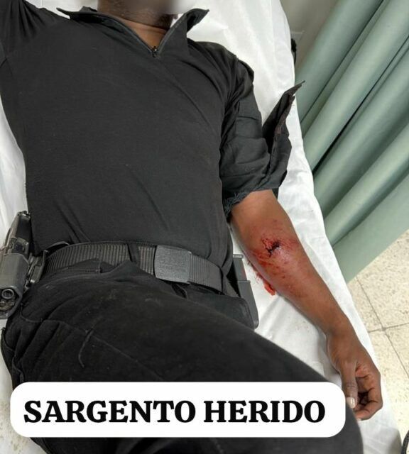 Sargento policial resulta herido en medio de acción legal en la cual fallecen los reconocidos delincuentes “Yamal” y “Julio 30-30”.