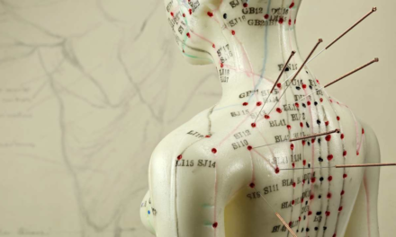 Acupuntura para el colesterol alto: ¿qué dice la ciencia sobre los puntos de la medicina tradicional china?