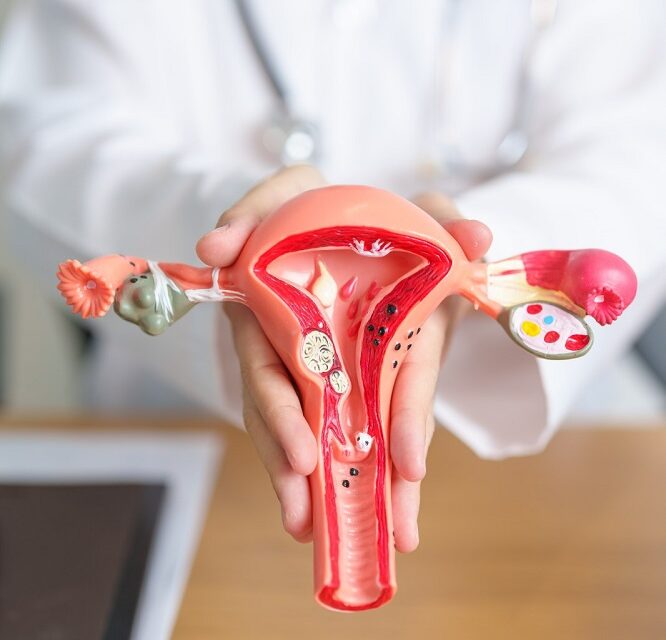 Vacuna contra el VPH: ¿por qué es tan importante para prevenir el cáncer de cuello uterino?