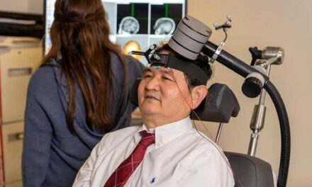 Casco de estimulación magnética especial para dejar de fumar